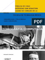 Tomografía Computada