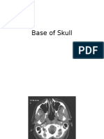 Axial CT scans in head and neck