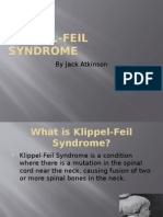 Klippel-Feil Syndrome