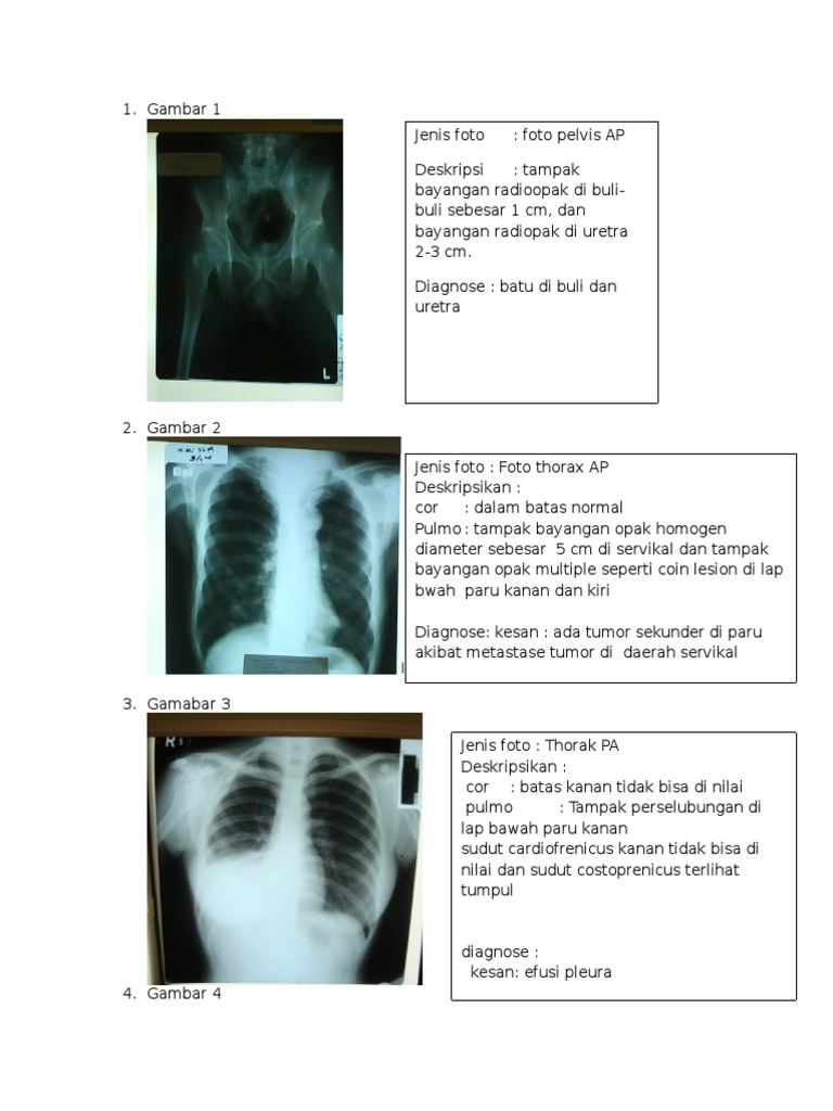 Diagnosa Radiologi Berbasis Foto Rontgen | PDF | Seni