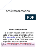 Ecg Interpretation Lecture 2014