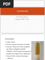 Leucemia