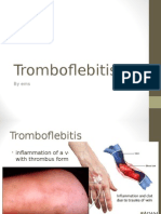 Tromboflebitis  1