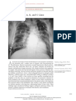 Kerley's A, B, and C Lines: Images in Clinical Medicine