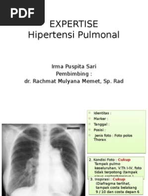 Ekspertise Hipertensi Pulmonal