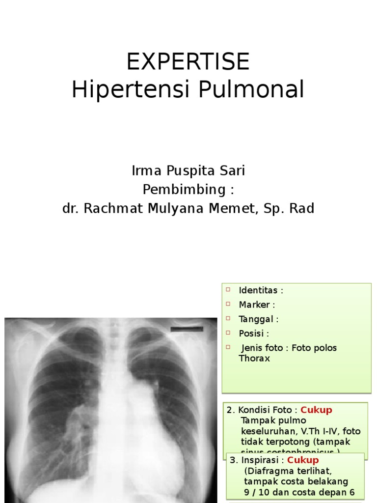 Obati Autoimun Dengan Resep Jsr Dr Zaidul Besar  Youtube