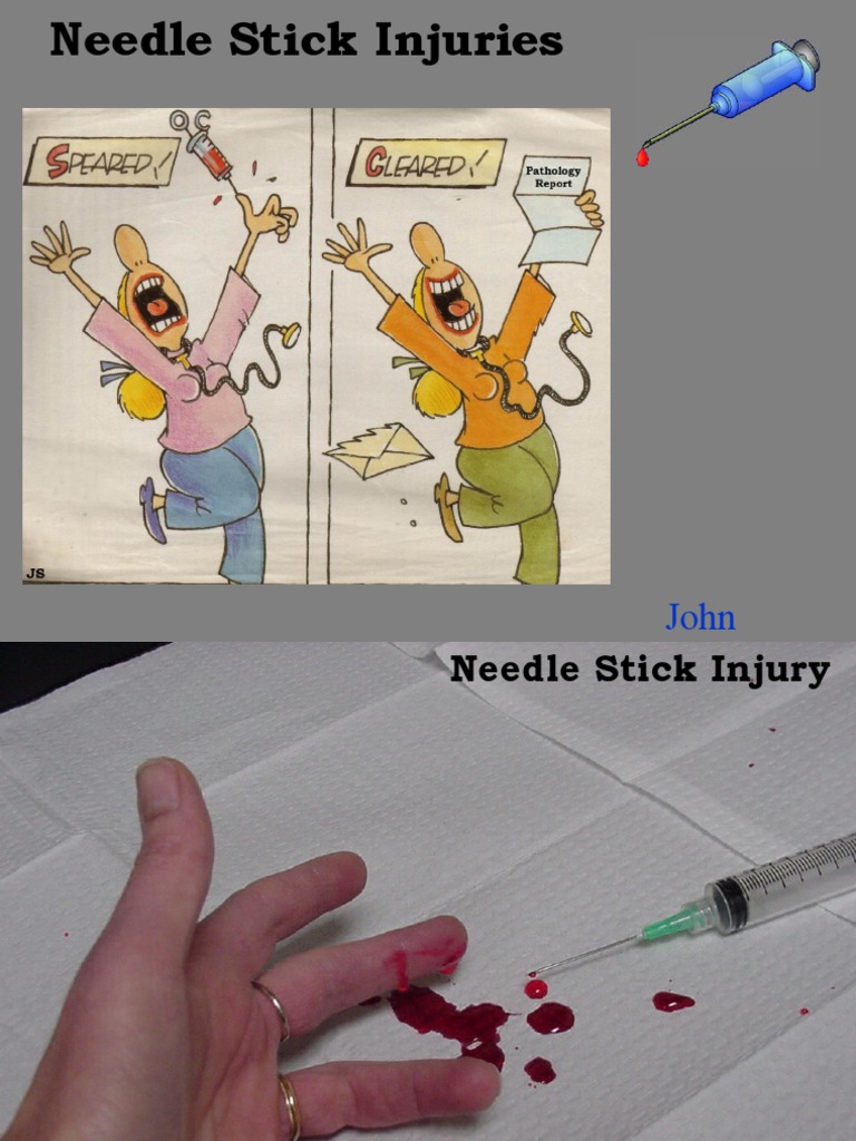 Needle Stick Injuries PDF Microbiology Clinical Medicine