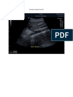 Estudios Abdominales