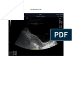 Estudio Pelvico 2