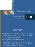 Gastroschisis - Siti Azureen