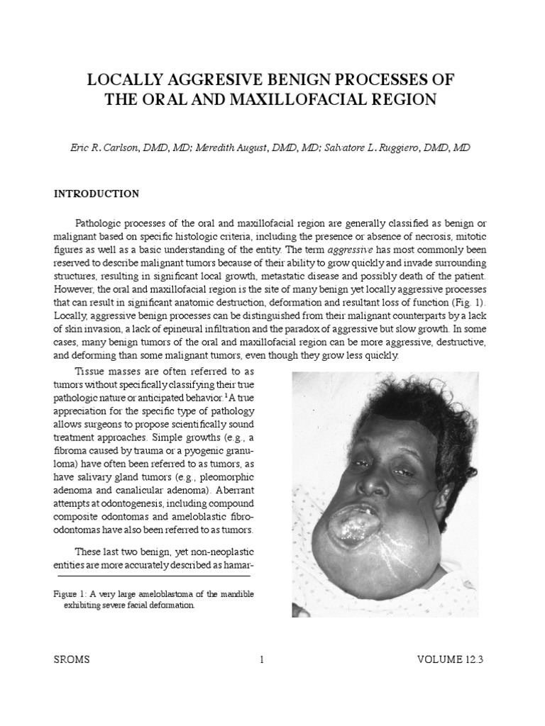 Ameloblastoma Cases Clinical Medicine Medical Specialties