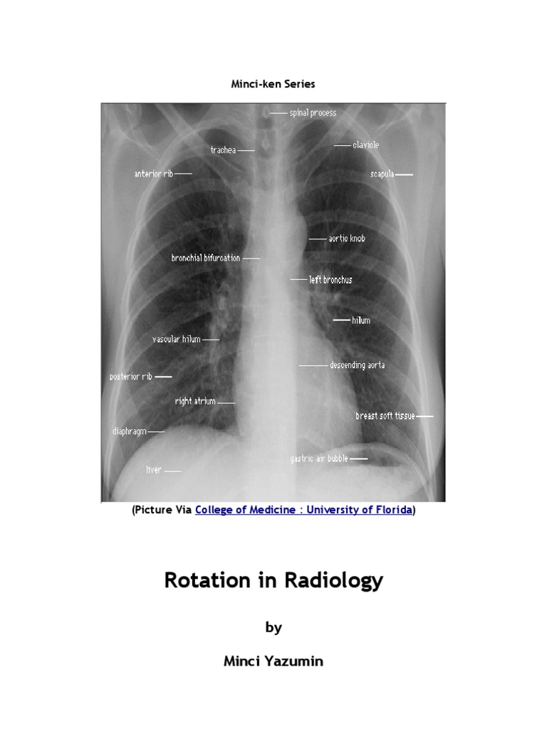 Rotation in Radiology PDF Radiology Patient