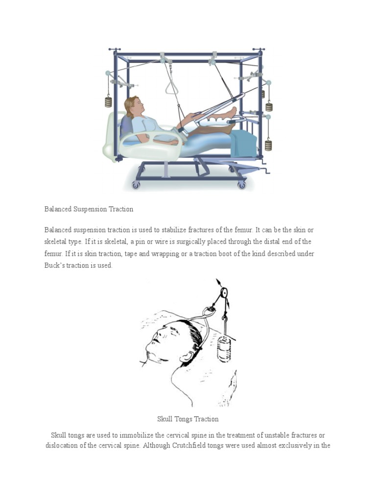Traction S | PDF | Vertebral Column | Human Leg