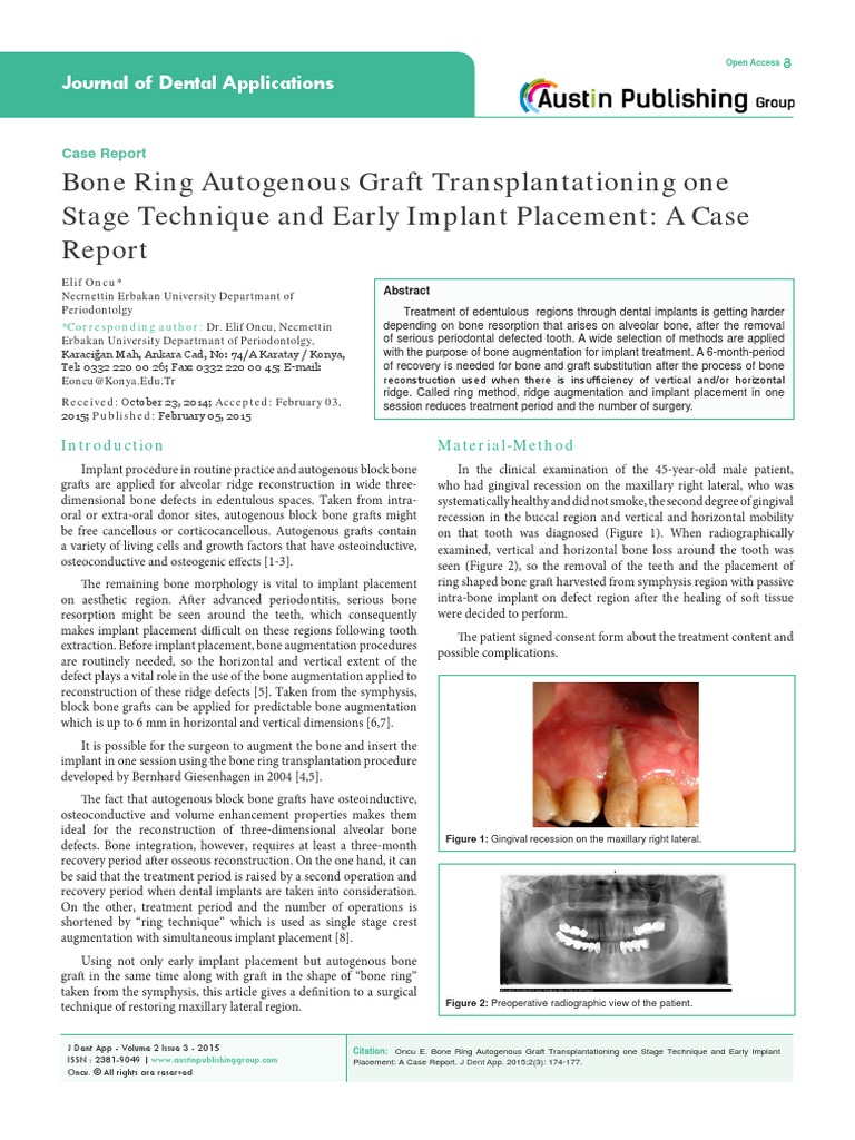 Bone Ring Graft for Dental Implants | PDF | Dental Implant | Surgery