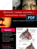 Epistaxis, Cuerpo Extraños y Traumatismo Nasofaciales