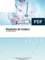 Displasia de Cadera PDF