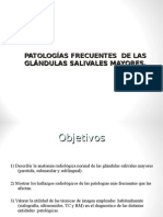 Patología Glandulas Salivales