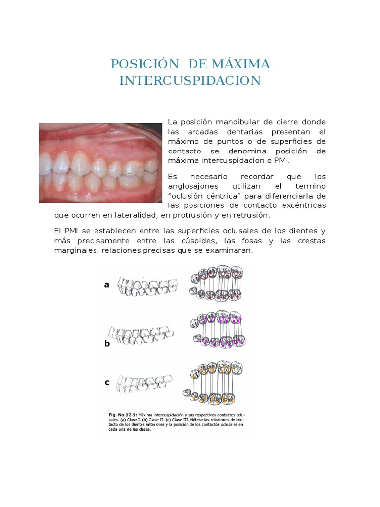 Posición de Máxima Intercuspidación | PDF