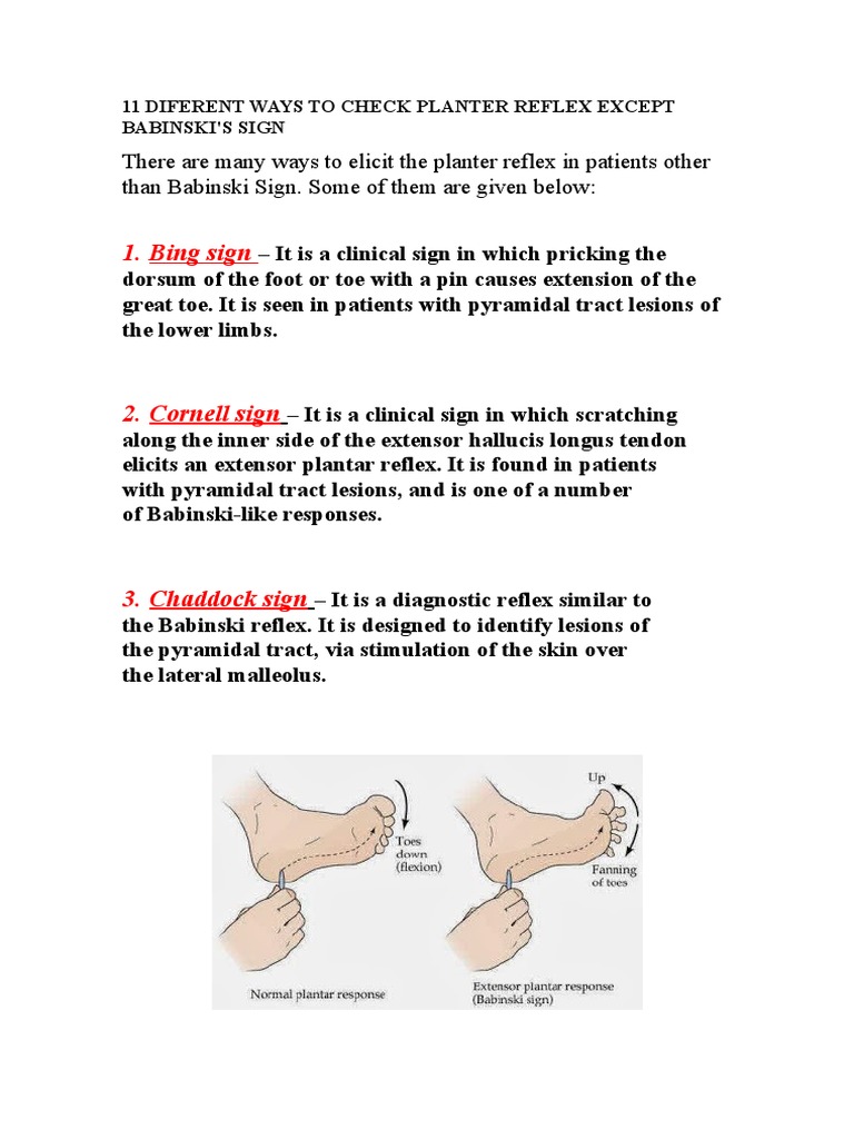 Alternative Methods for Plantar Reflex Testing | PDF