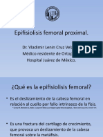 Epifisiolisis Femoral Proximal