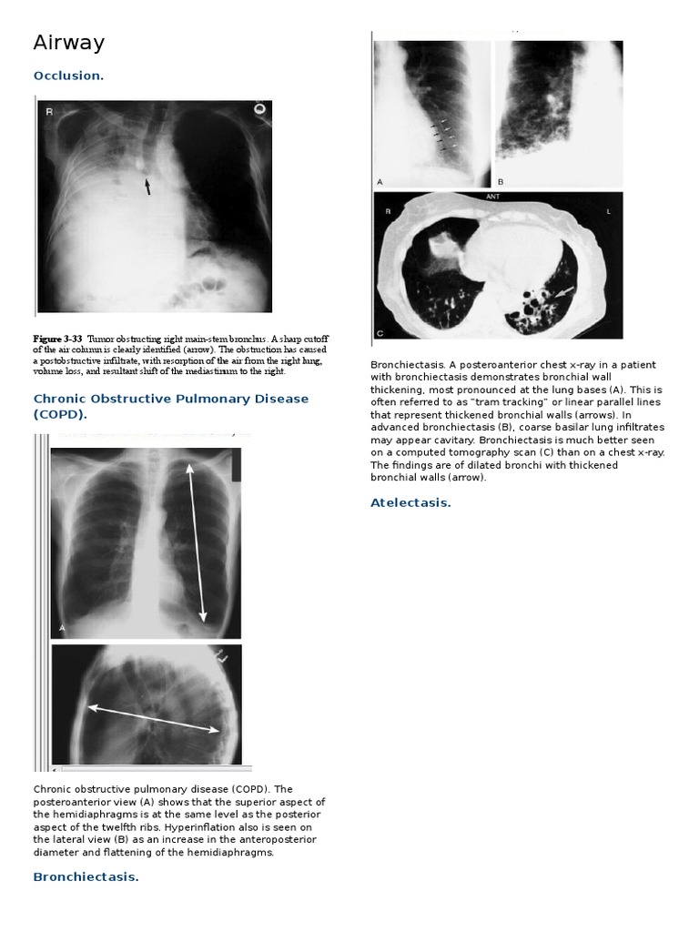 RADIOLOGI | PDF | Lung | Thorax