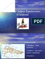 Clubfoot Presentation