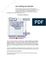 How To Read Audiogram Results