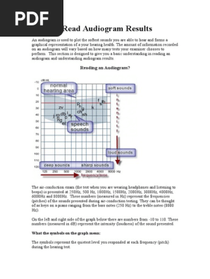 How to Read Audiogram Results