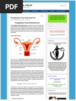 Download Pengobatan Polip Endometrium  OBAT HERBAL POLIP by Agus Salam SN293305900 doc pdf