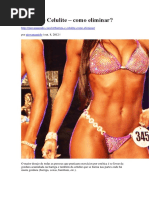 Barriga e Celulite – Como Eliminar