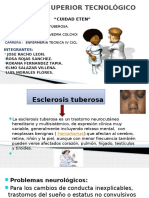 Esclerosis Tuberosa Mama Diapositivas