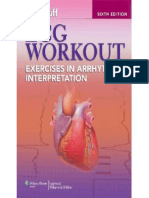 ECG Workout - Excercises in Arrhythmia Interpretation