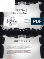 Hipoplazia şi   Fluoroza