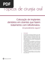 Colocação de implantes dentários em doentes que fazem tratamento com bifosfonatos
