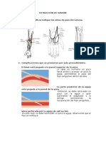 Extraccion de Sangre