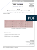 ECG Quiz