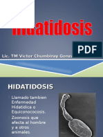 Hidatidosis