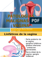 Patologias Malignas de La Vagina