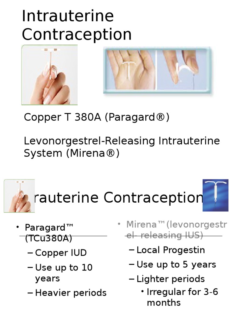 Intrauterine Devices (IUD) Contraception | PDF | Fertility | Human ...