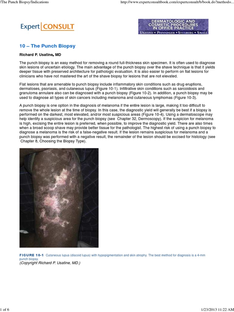 The Punch Biopsy Indications PDF Biopsy Cutaneous Conditions