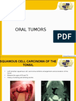 Oral Tumor Path