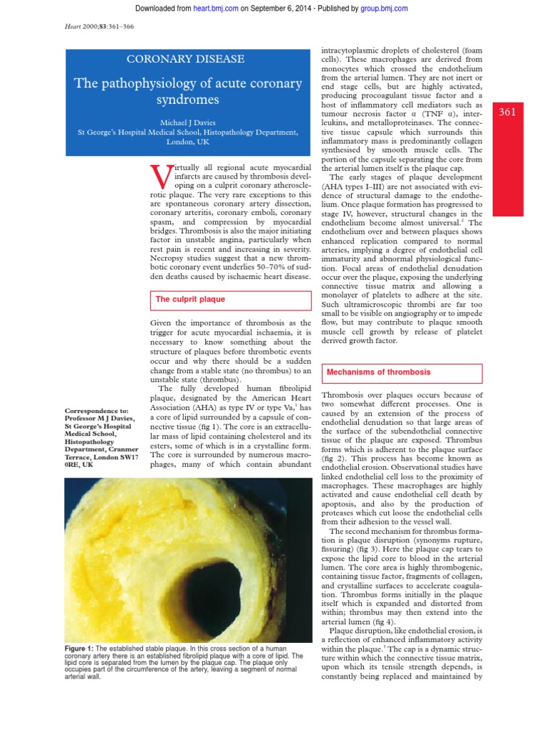The Pathophysiology of Acute Coronary Syndromes | PDF | Atheroma ...