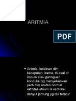 ARITMIA