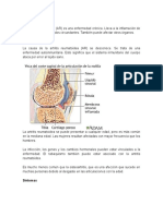 Artritis Reumatoidea