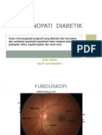 retinopati diabetik nilam