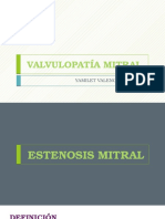 Valvulopatía Mitral