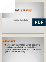 Bells Palsy 