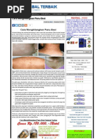 Download CaraMenghilangkanPanuBesibyFebyAwalRamdhaniSN294185813 doc pdf