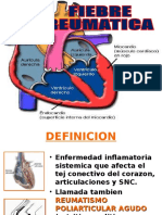 Fiebre Reumatica Abril 2014