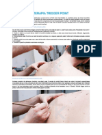 Terapia Trigger Point